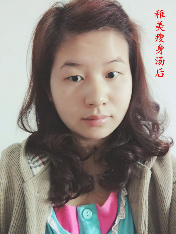 稚美创造汤总代理-叶柳瘦身瘦身奇迹-青青岛社怎黱瘦脸图片
